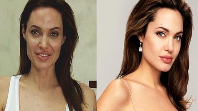 What’s It Like Being Average Looking Or Unattractive? Is Life Really So Different From Conventionally Attractive People?