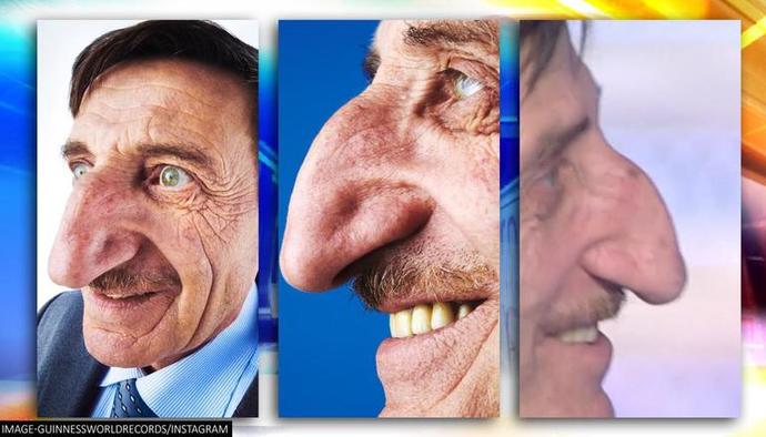 Does a big nose make guys ugly?