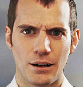 Should balding men shave their heads or keep receding hairlines?