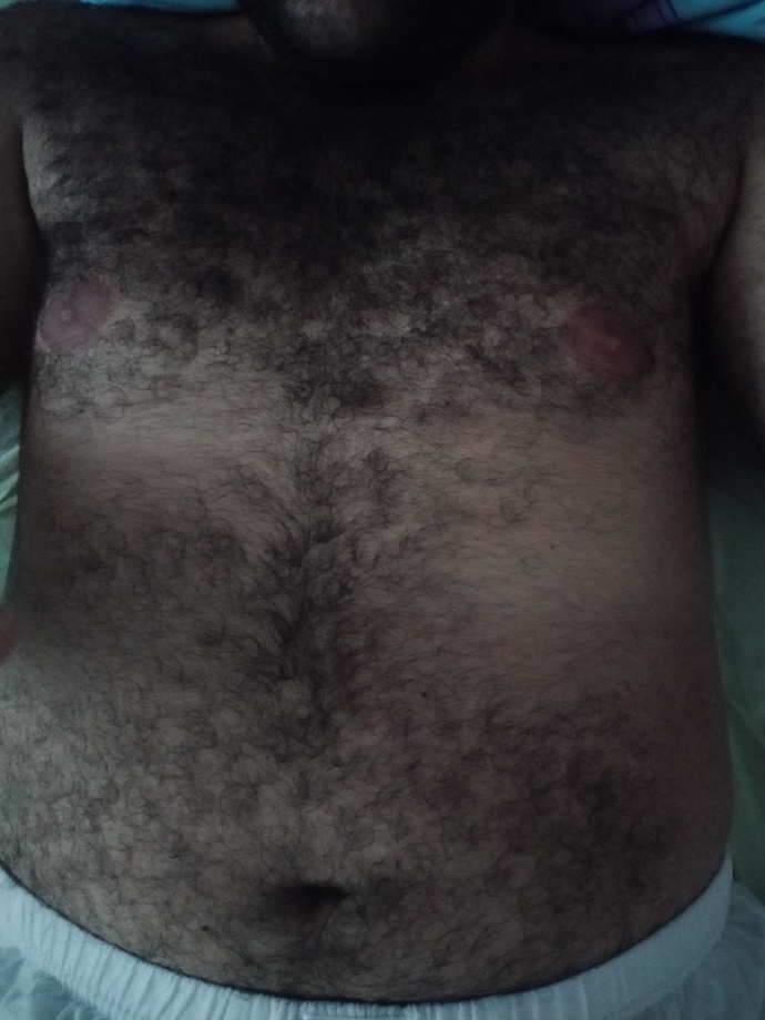 Do I have too much body hairy?
