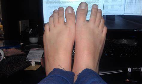 Are your FEET the SAME or DIFFERENT sizes?