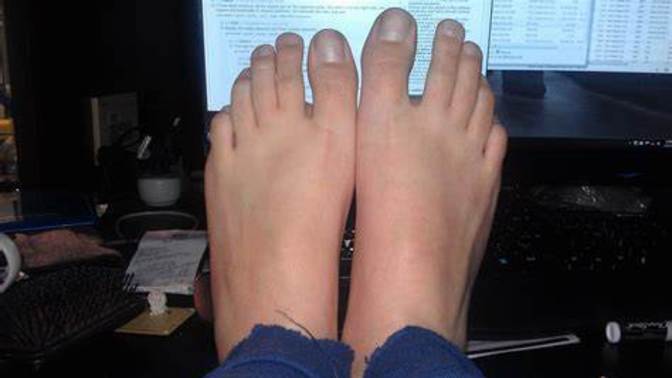 Are your FEET the SAME or DIFFERENT sizes?