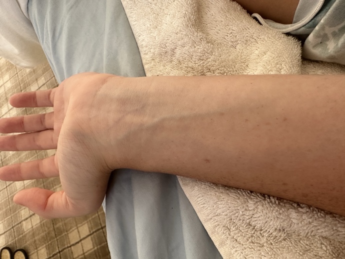 What is my skin undertone?