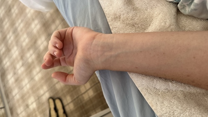 What is my skin undertone?