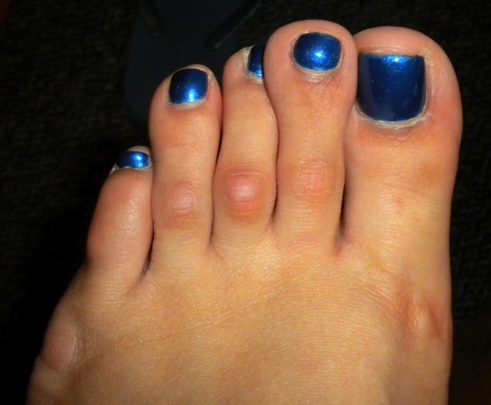 Are my weird feet a dealbreaker?