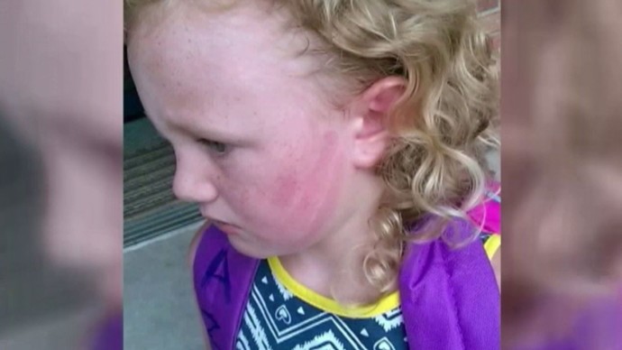 Is slapping your child in the face considered child abuse?