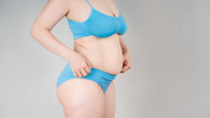 Do you consider this woman to be overweight?