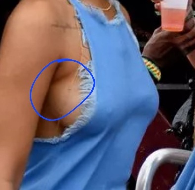 Side boob crease