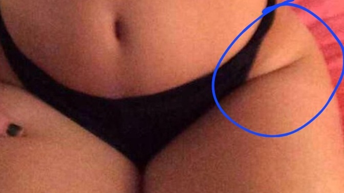 Guys, do you find these parts attractive on a woman (the crease)?
