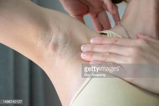 Little lump in armpit?