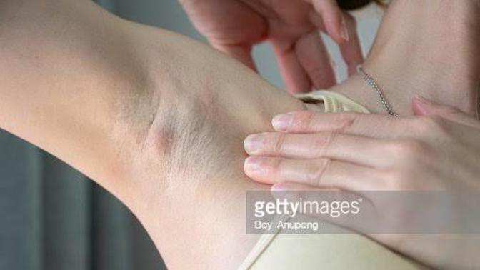 Little lump in armpit?