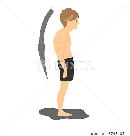 Would you date a guy with nice looks but bad posture?