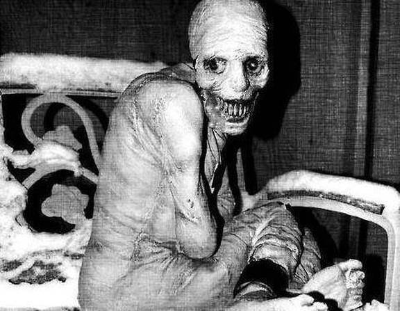 (+18 - Graphic) Have you not heard of the Russian Sleep Experiment?