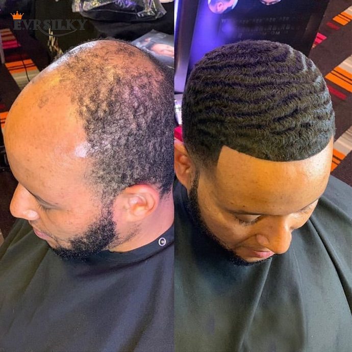 Would you care if a man you liked wore a wig instead of having a hair transplant?