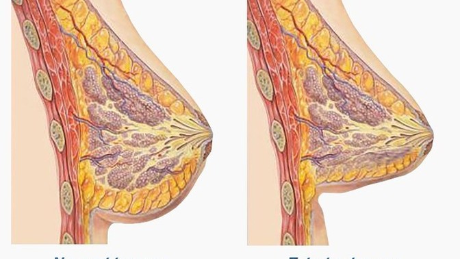 Any woman with tuberous breasts? How do you live with it?
