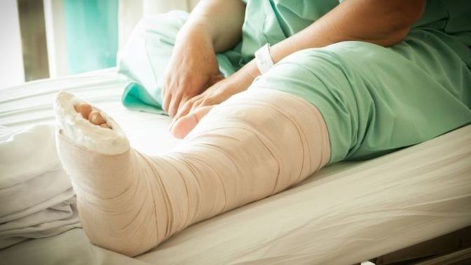 Have you ever broken a limb? How did you manage recovery?