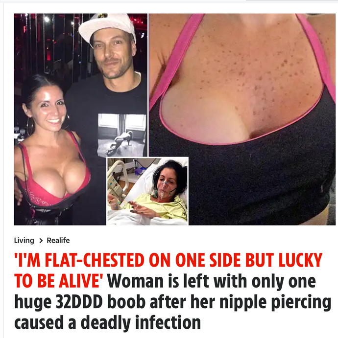 If your 15 year old daughter came to you and said she wants to get her nipples pierced, but needs your consent, do you allow her?
