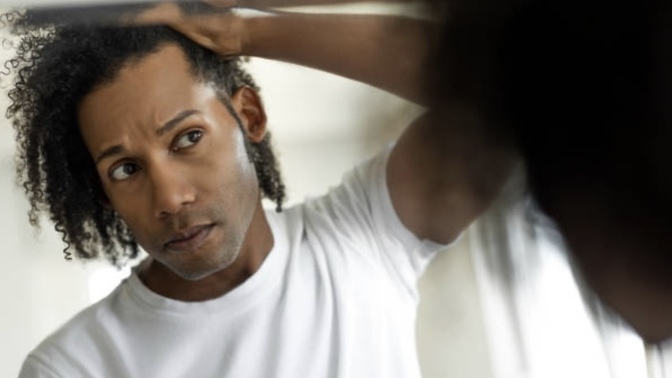 Guys, What age does your hairline start receding?