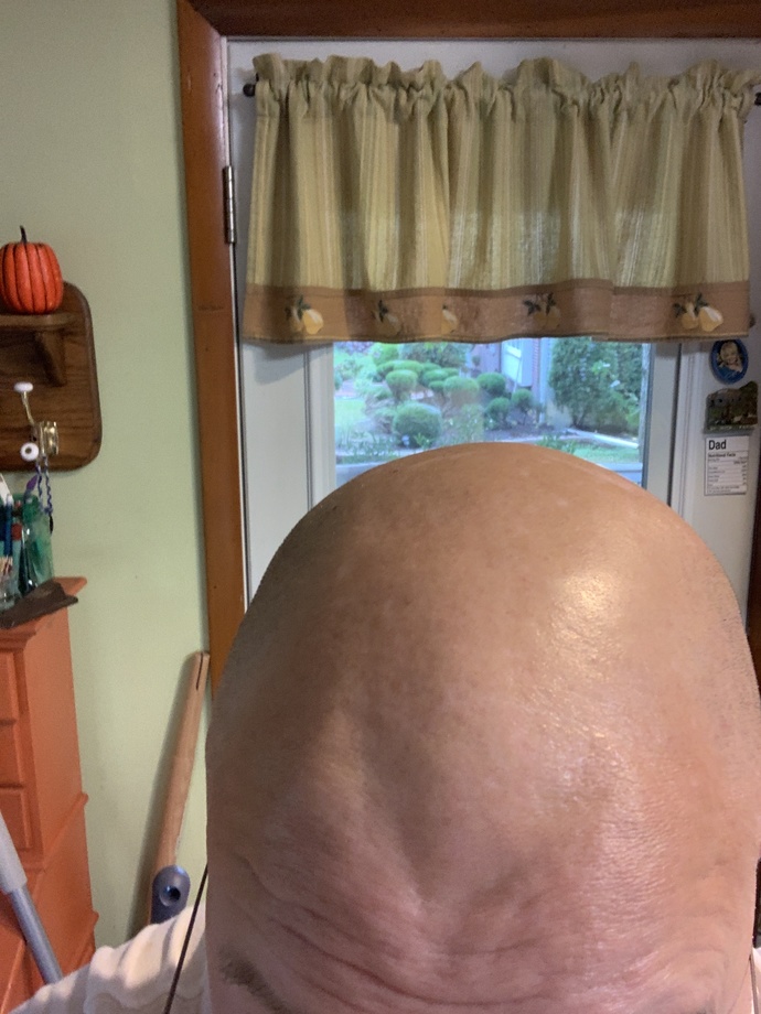 Balding guy at 20, what may I do to compensate for this flaw?