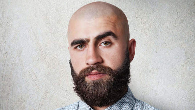 Balding guy at 20, what may I do to compensate for this flaw?