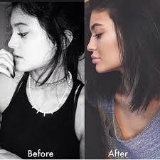 Does anyone think women who pump of their lips look good?