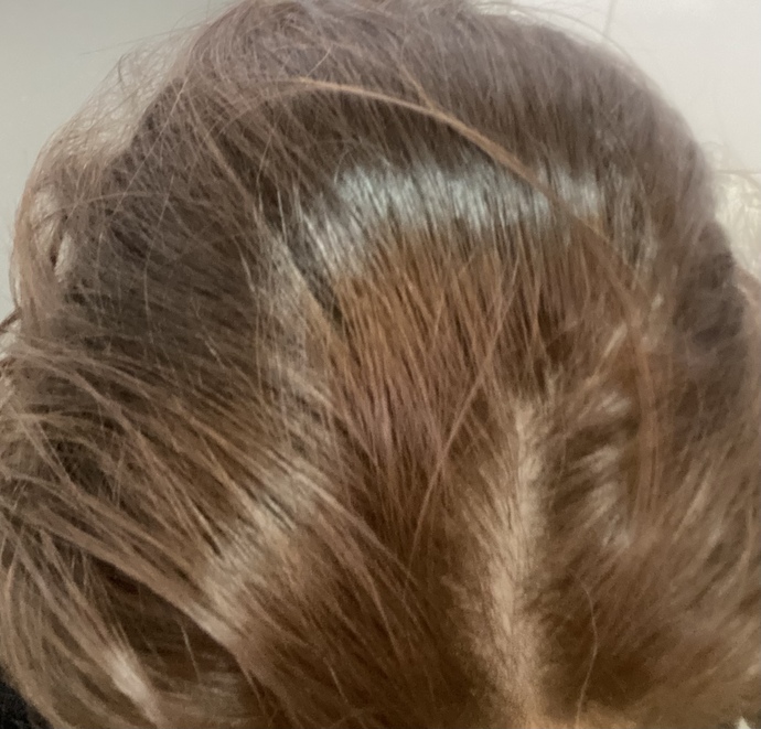 I dyed my hair and Im not sure if it came out well, Ill put a picture. please see if its good or damaged?