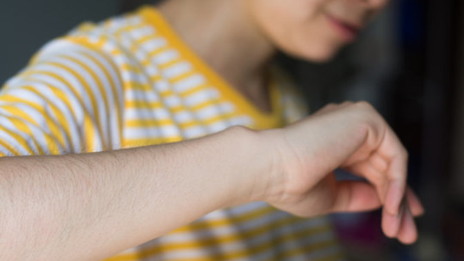 How do I tell my girlfriend that she has such a hairy arms and I don't like them?
