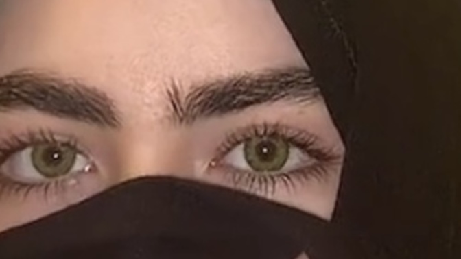 My best friend has the most beautiful eyes i’ve ever seen and plastic surgeons agree how does one even achieve this?