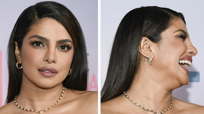 Do you have a better looking front profile or side profile?