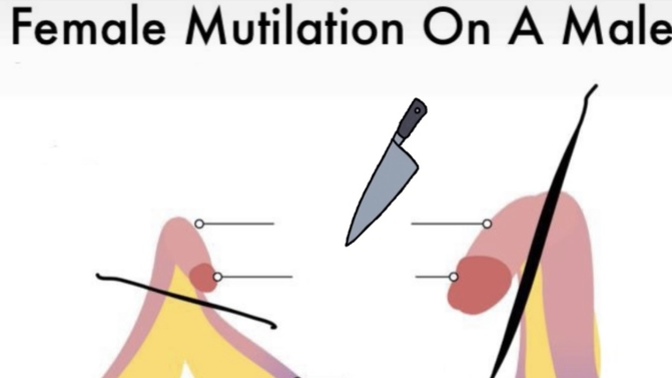 Do you know what FEMALE CIRCUMCISION is?