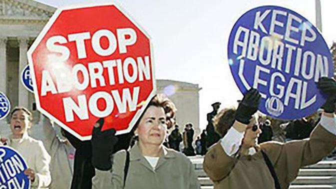 What is your opinion about abortion? Should women be allowed to do that?