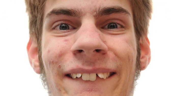 Why don't people who have messed up teeth and can afford it just go fix them?