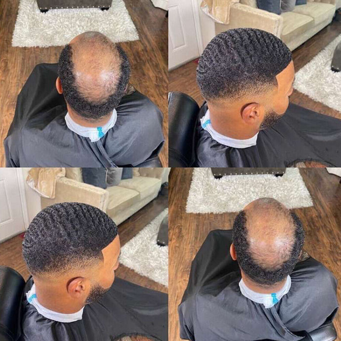 Have you ever seen a man wearing a hair piece?