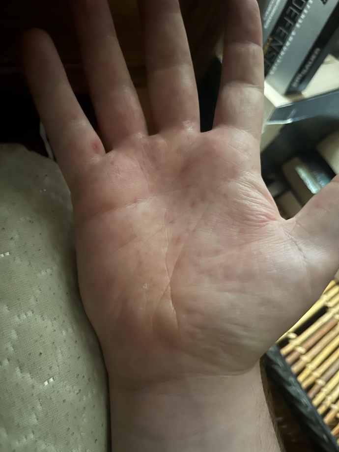 What could cause this?