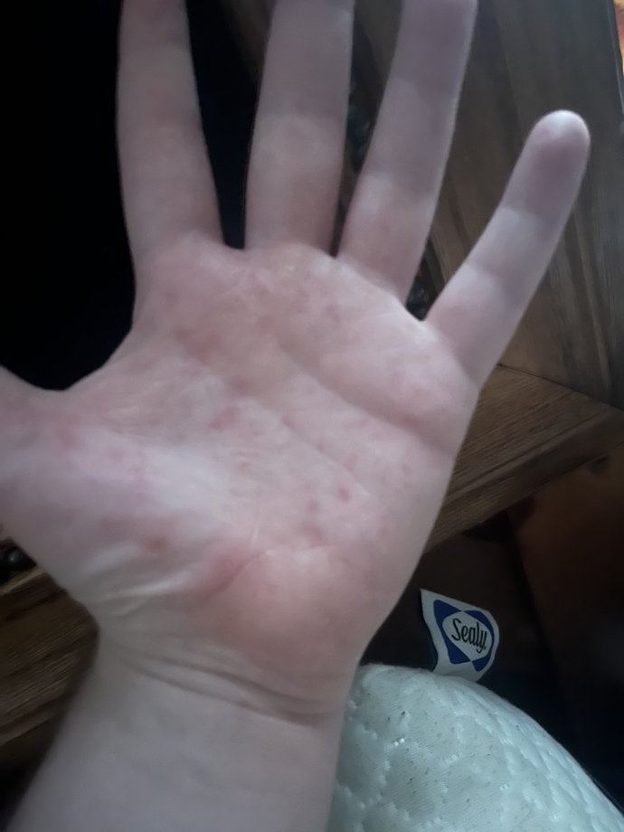 What could cause this?