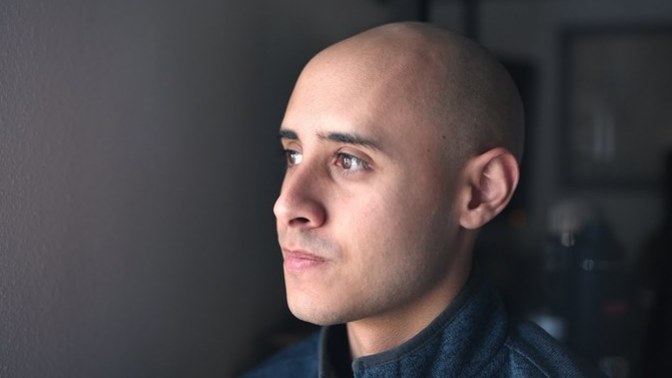 What is the importance of hair on a guy? What physical traits might compensate for this flaw?
