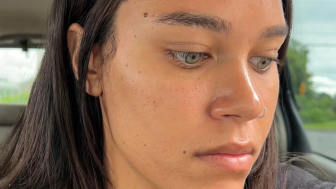 Do you prefer women's faces with or without small "imperfections" like moles, freckles, birth marks, scars, etc?