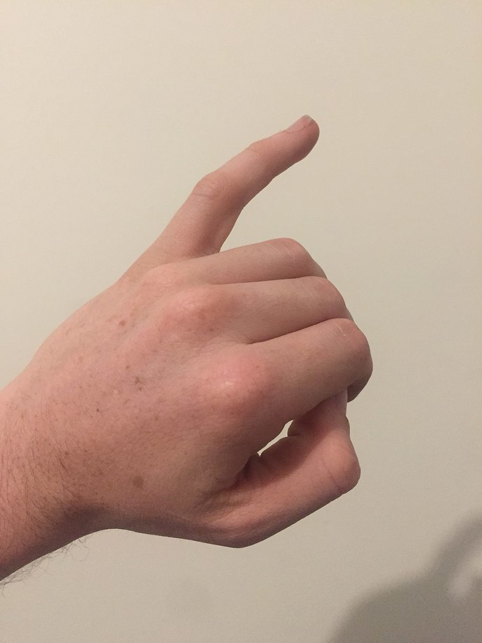 Have you ever realized how important your PINKY FINGER is?