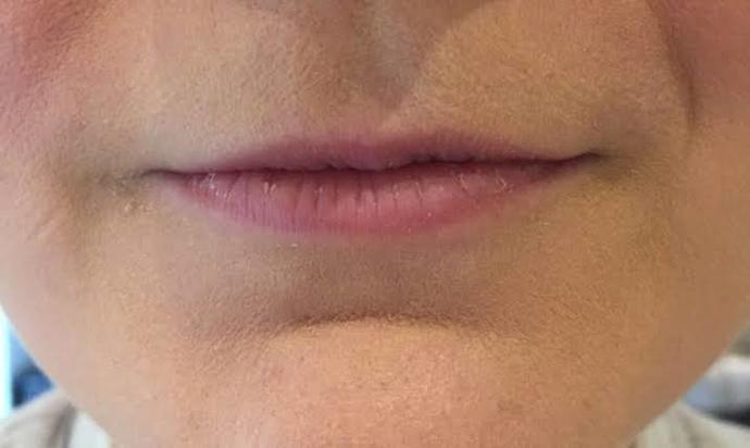 Why do people accuse stunning/very conventionally attractive people of plastic surgery?