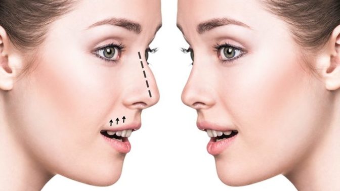 Have you ever thought about getting a plastic surgery/procedure?