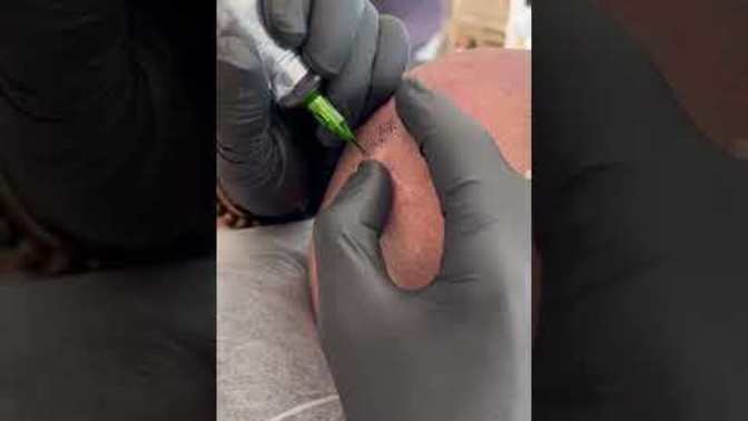 What do you feel about scalp micropigmentation?