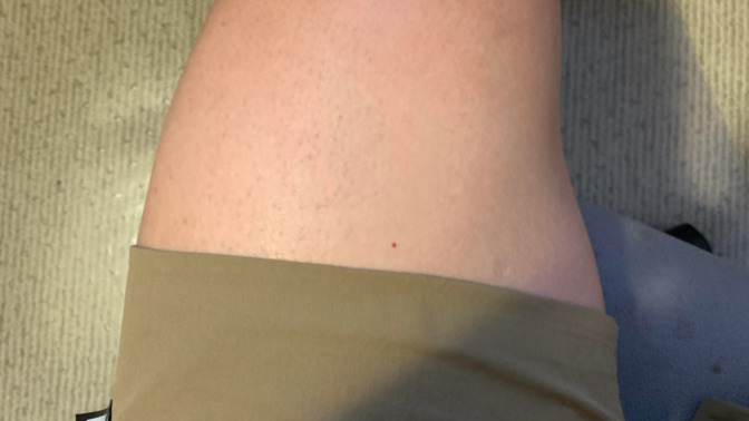 Do you give a shit if a guy's shorts ride up "too much" when he sits down?