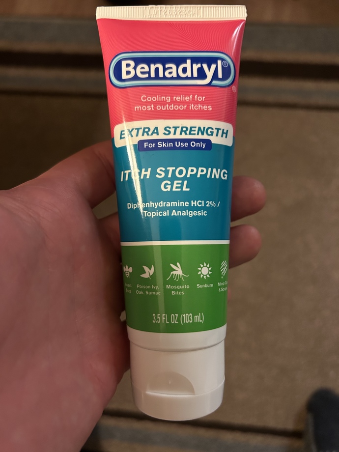 What’s the best treatment for chigger bites?