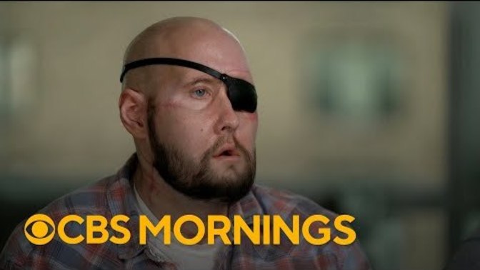 Would you ever get an eye transplant if god forbid you could no longer see out of one?
