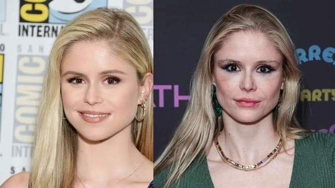 Why do women ruin their looks with plastic surgery very often?