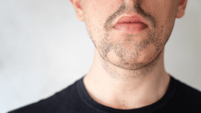 Guys, if you can't grow a beard/have a super patchy beard, how do you feel/how have you felt about that as a man?