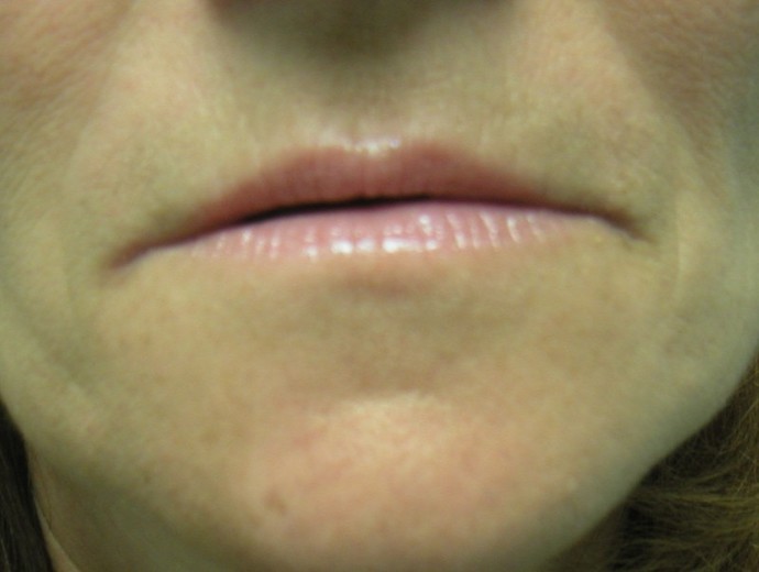 Example 