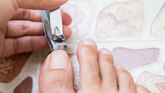 How often do you TRIM your TOE NAILS?