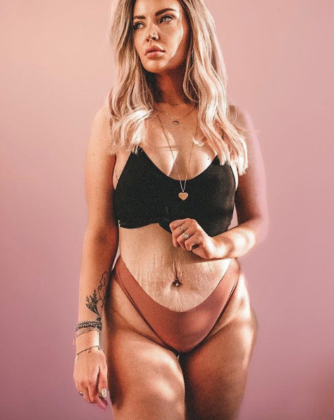 Mom bod