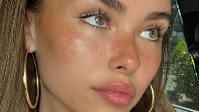 What's your opinion on freckles?